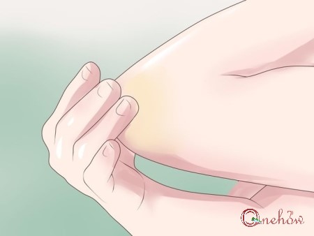 چگونه سیاهی آرنج را درمان کنیم
